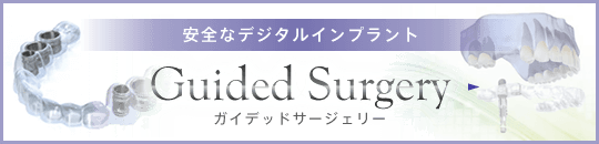 安全なデジタルインプラント「ガイデッドサージェリー」