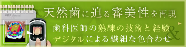 「歯科医師の熟練の技術と経験」「デジタルによる精密な調整」