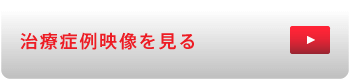 治療症例映像を見る