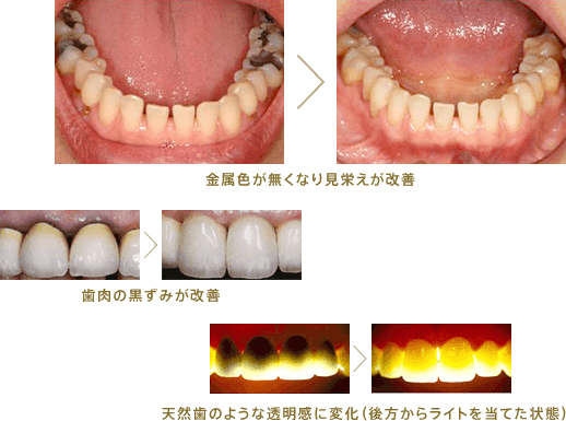 症例