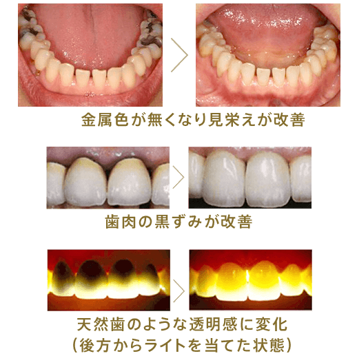 症例