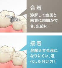 「合着」「接着」の違い